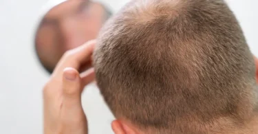 mydetox-gano-excel-ganoderma-alopekia-nees-elpides-ploysia-ygih-mallia