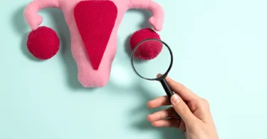 mydetox-gano-excel-ganoderma-syndromo-polykystikon-wothikwn-pcos