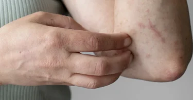 mydetox-gano-excel-boitha-ganoderma-meta-diagnwsh-knidwshs