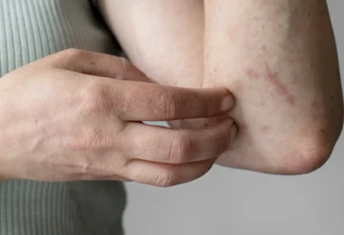 mydetox-gano-excel-boitha-ganoderma-meta-diagnwsh-knidwshs