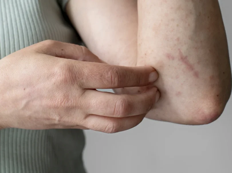 mydetox-gano-excel-boitha-ganoderma-meta-diagnwsh-knidwshs